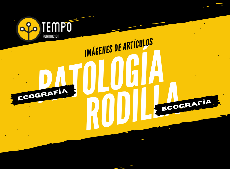 ecografia-y-patologia-de-la-rodilla